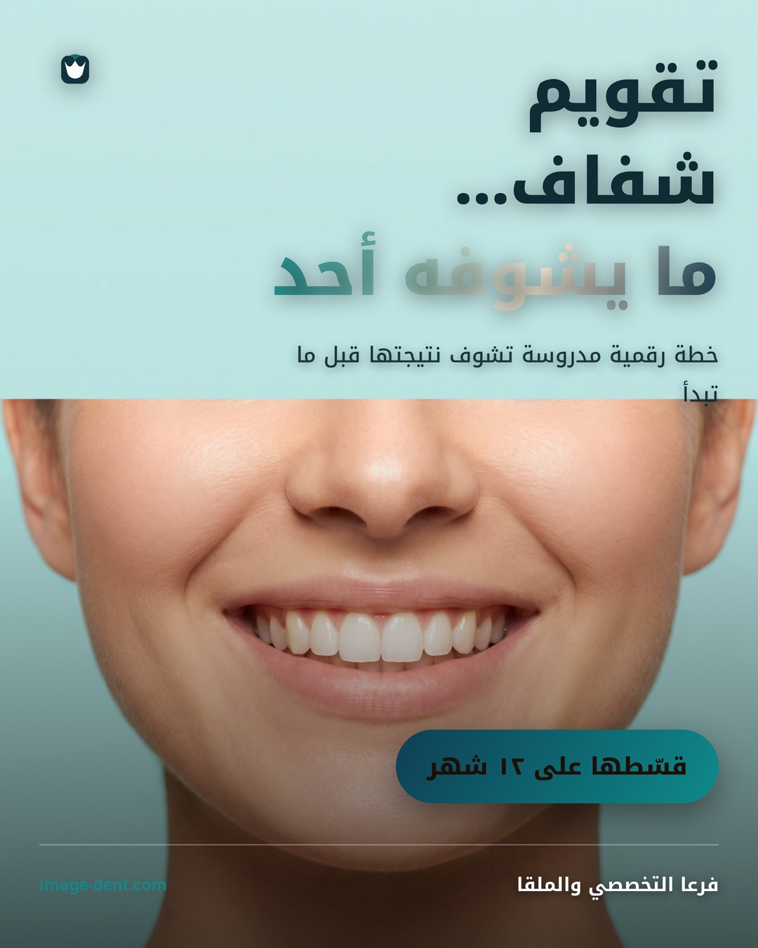 إعلان تقويم شفاف
